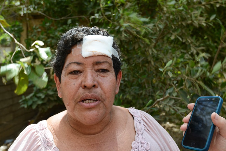Martha Martínez, pobladora de la comunidad afectada por la falta de agua, resultó con una herida en la cabeza, por el enfrentamiento entre vecinos. Carlos Herrera / Confidencial